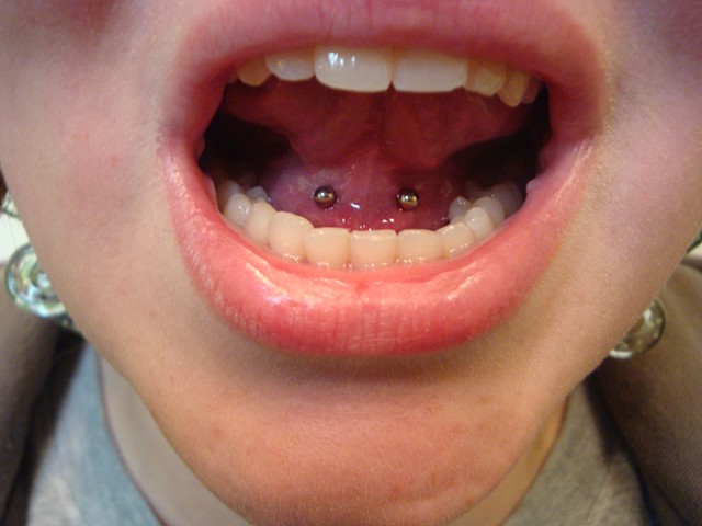 Oral Piercing